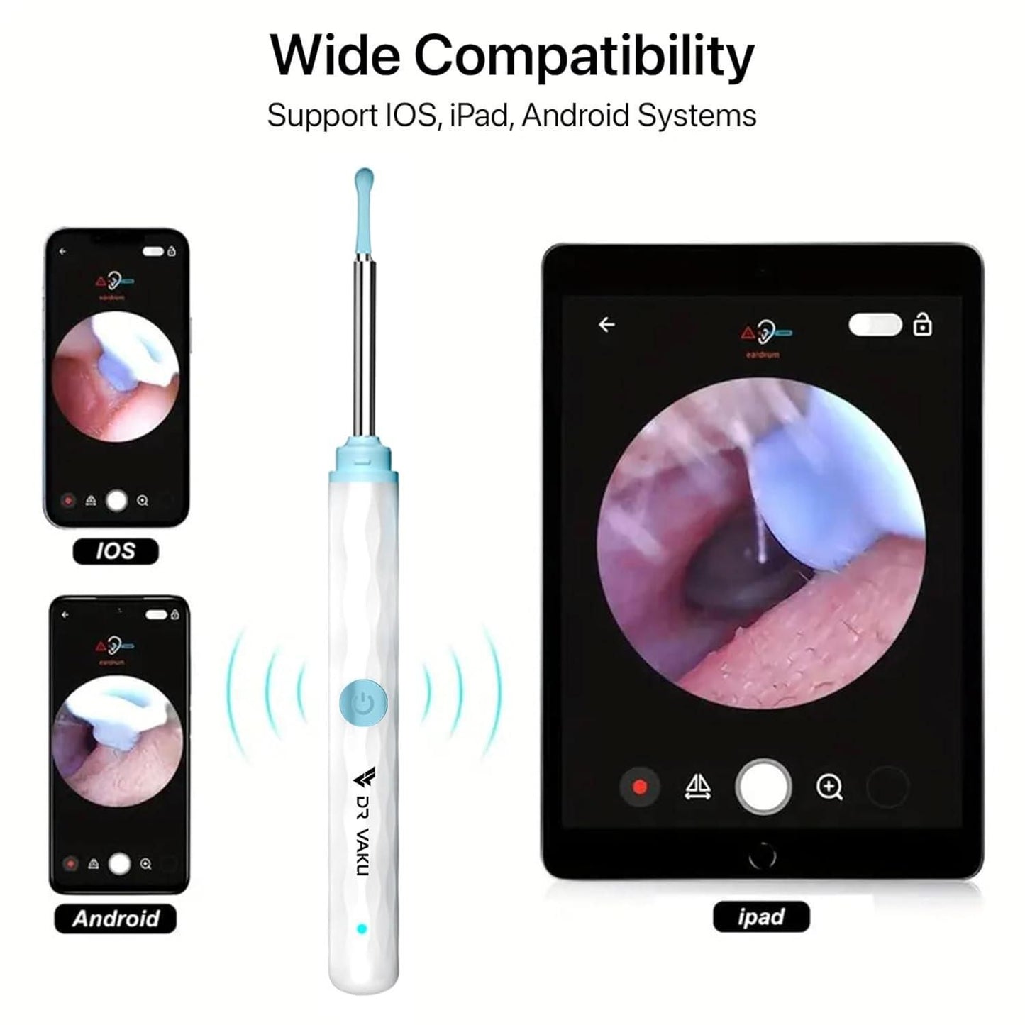 Smart Earwax Removal Kit with HD Camera & WiFi (7-Piece Set, 6 LED, iOS/Android Compatible)
