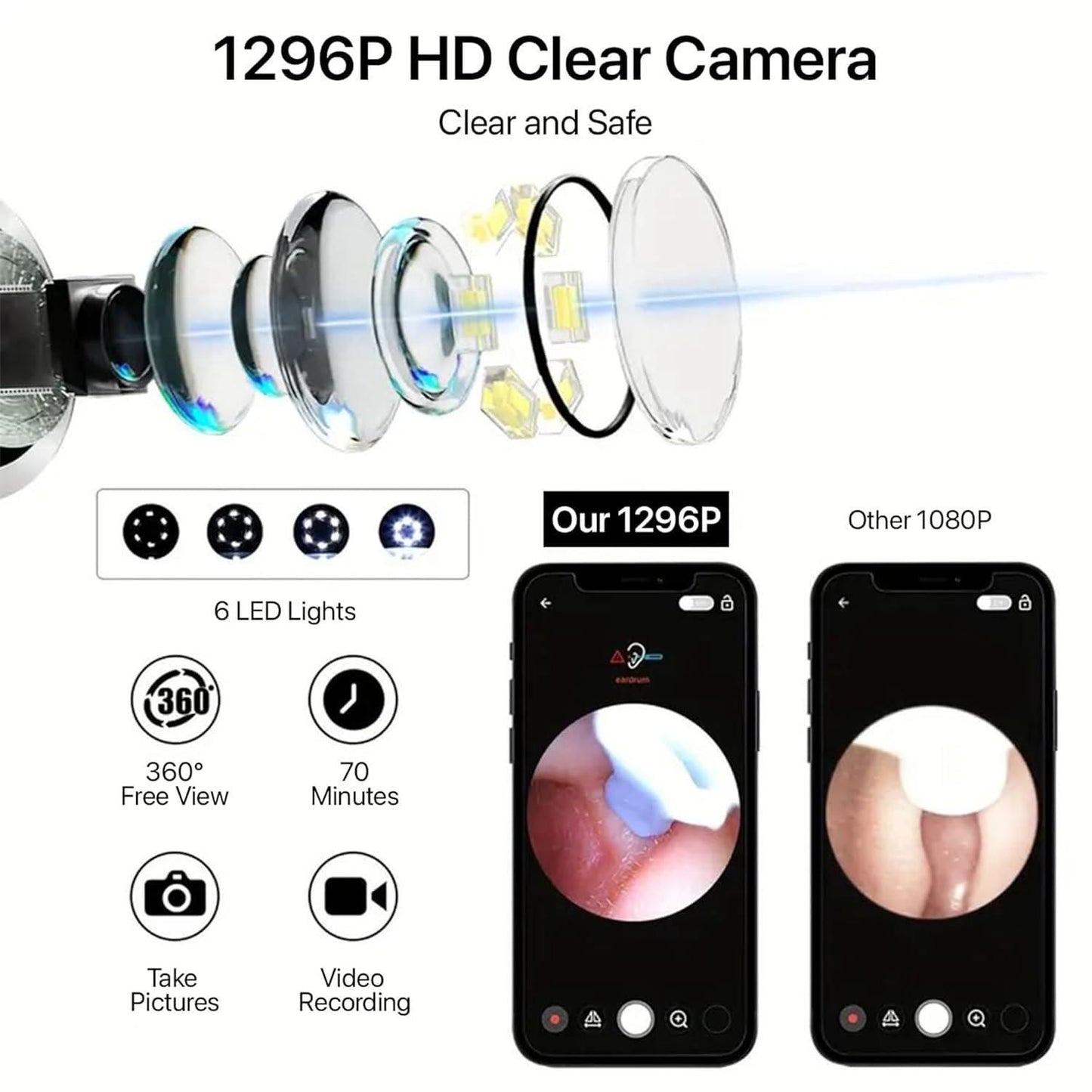 Smart Earwax Removal Kit with HD Camera & WiFi (7-Piece Set, 6 LED, iOS/Android Compatible)