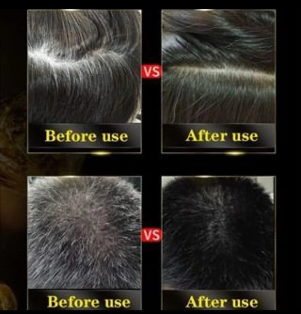 Ayurvedic Black Hair Shampoo 3 in 1-100ml (Buy One, Get One FREE)